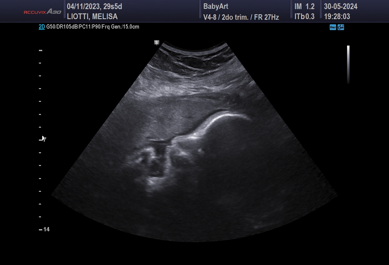 JULIA DE MELISA LIOTTI_0000.JPG